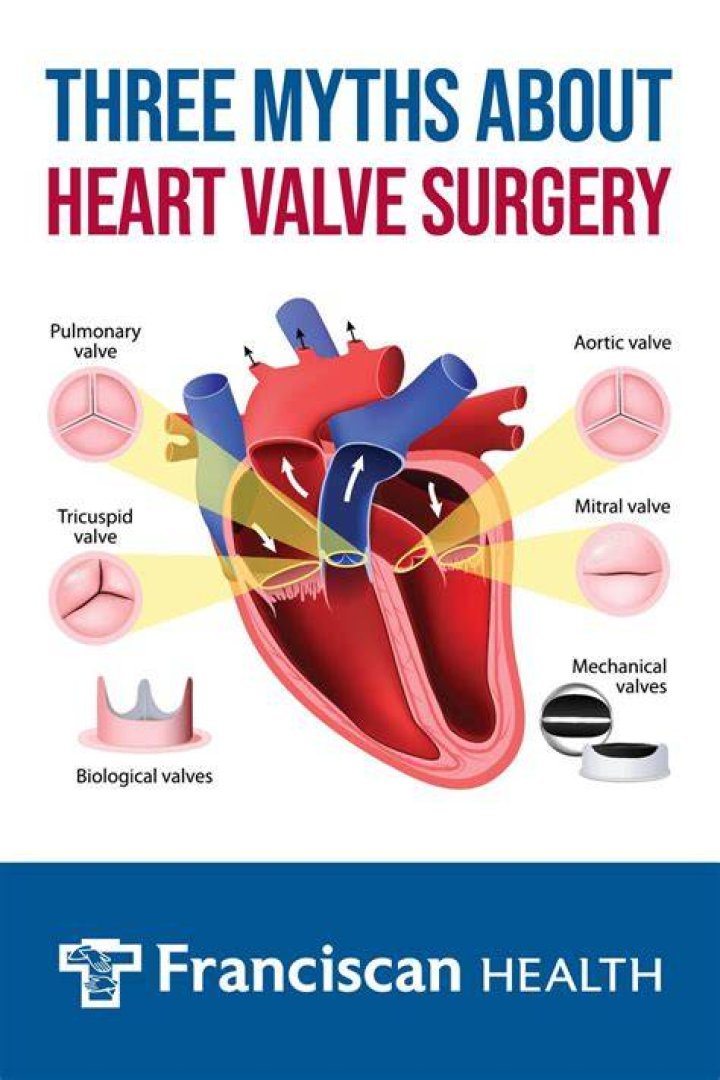 3 Myths About Heart Valve Surgery Franciscan Health