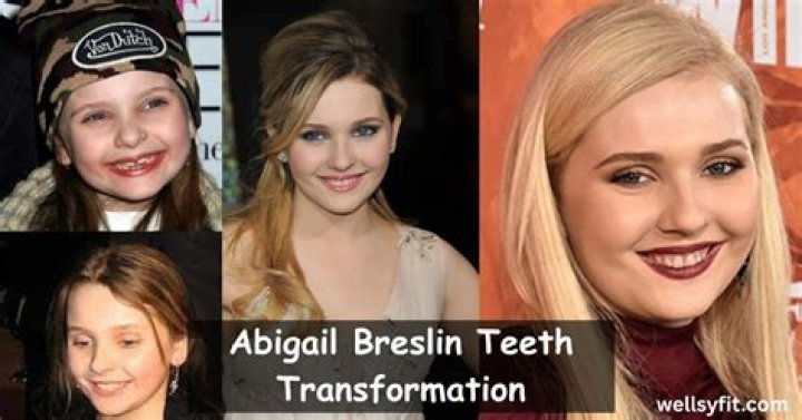 Abigail Breslin Teeth Transformation Journey Journal Press
