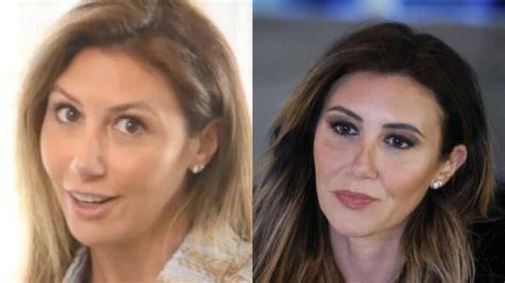 Alina Habba Plastic Surgery Has She Gone Under the Knife?