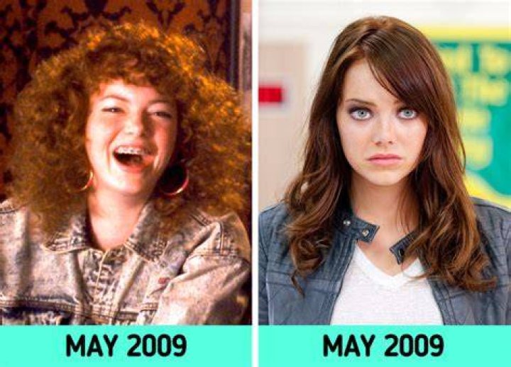 Alluring Emma Magnolia Before Plastic Surgery Before And After Photos
