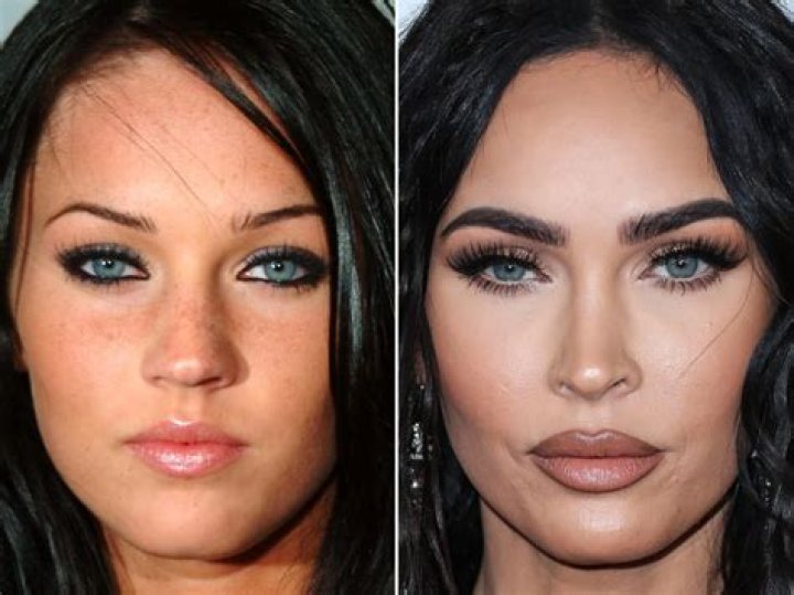 Are Megan Fox Plastic Surgery Rumors True? Women In The World