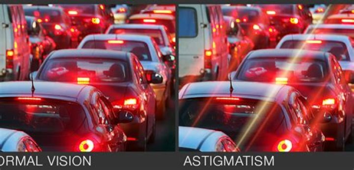 Astigmatism Vs No Astigmatism Lights Astigmatism Swollen