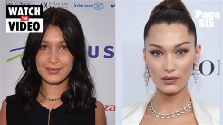 Bella Hadid Regrets Getting a Nose Job at 14