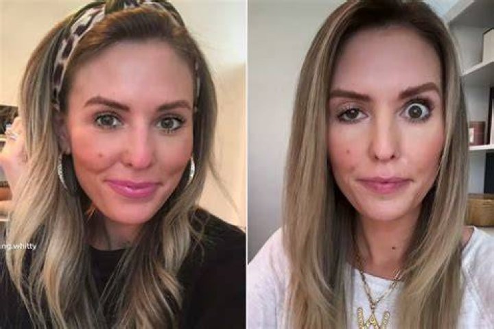 Botox Influencer compartilha sua experi&ecirc;ncia tr&aacute;gica com o