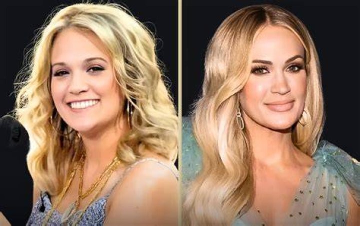Carrie Underwood before and after plastic surgery Celebrity plastic