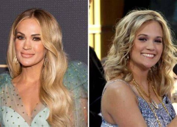 Carrie Underwood Plastic Surgery Did She Get Lip Surgery? Luv68
