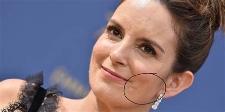 Celebrities with Facial Scars Health Guide Net