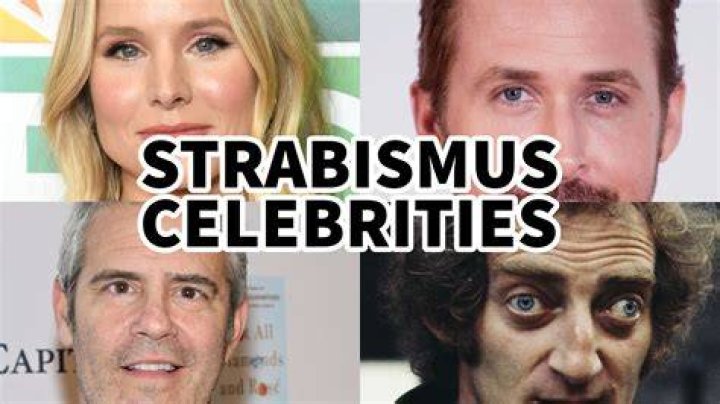 Celebrities with Strabismus List of Famous People with Lazy Eyes