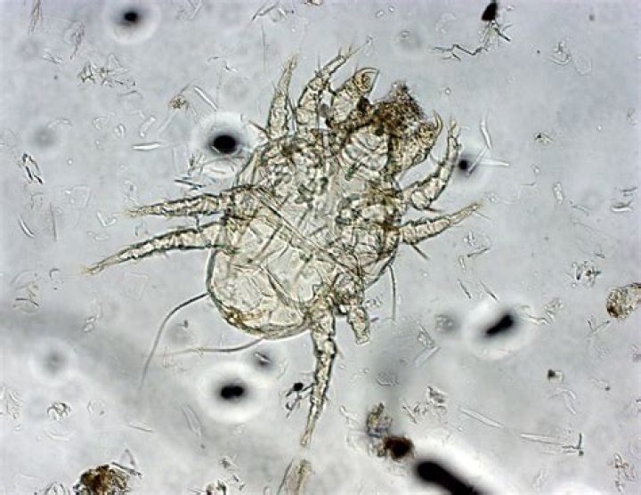 Cheyletiella The walking dandruff Worms & Germs Blog