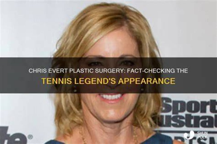 Chris Evert Plastic Surgery. Tennis Star's Ovarian Cancer Update And