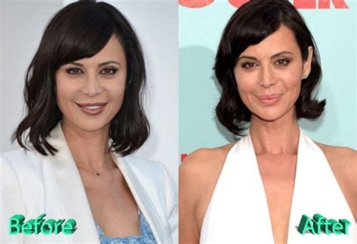 Did Catherine Bell Have Plastic Surgery? (Before & After 2022)