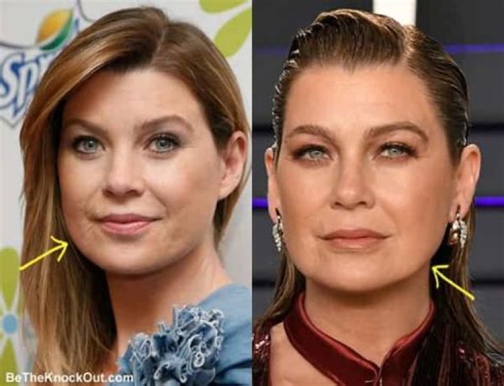 Did Ellen Pompeo Get Plastic Surgery? Transformation in Photos