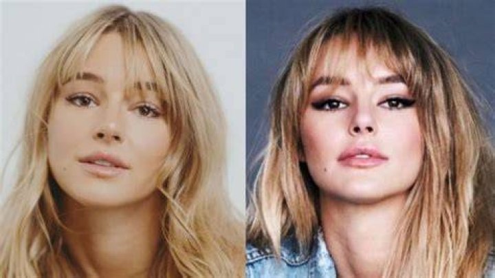 Did Hassie Harrison Undergo Plastic Surgery? Unveiling Her Stunning