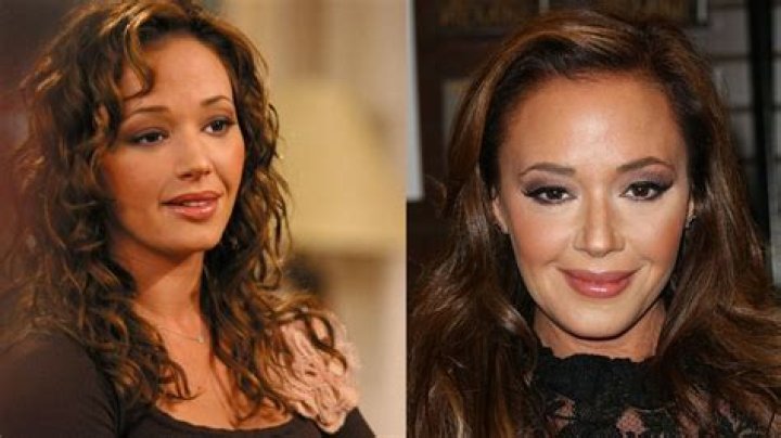 Did Leah Remini Get Plastic Surgery? Experts Weigh In!