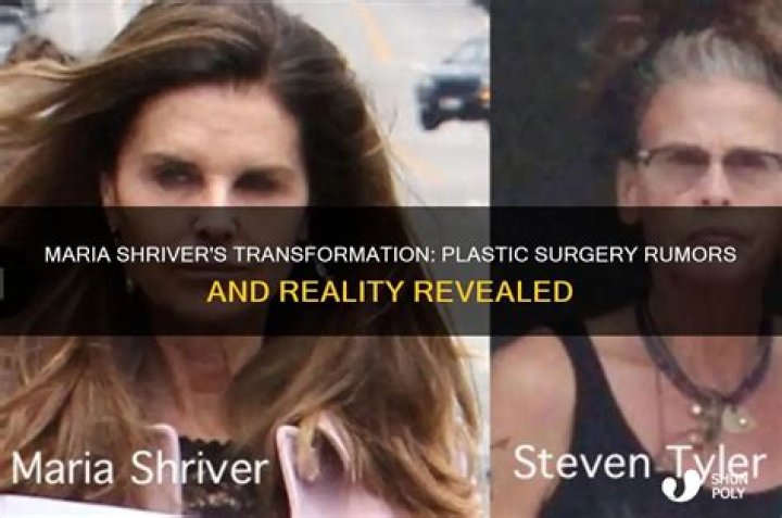Did Maria Shriver Have Plastic Surgery? Rumors of Facelift, Fillers