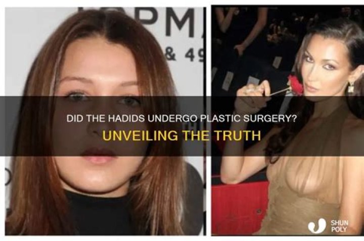 Did Mikaela Testa Undergo Plastic Surgery? Surgery Lists