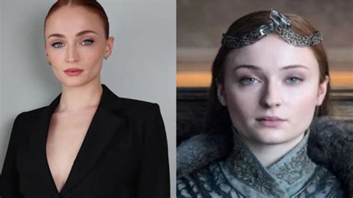 Did Sophie Turner opt for buccal fat removal after Joe Jonas used