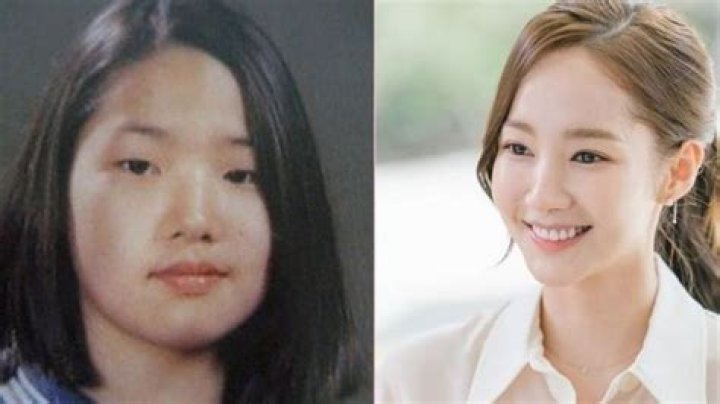Dijuluki Queens of Surgery, 5 Transformasi Aktris Korea Park Min Young