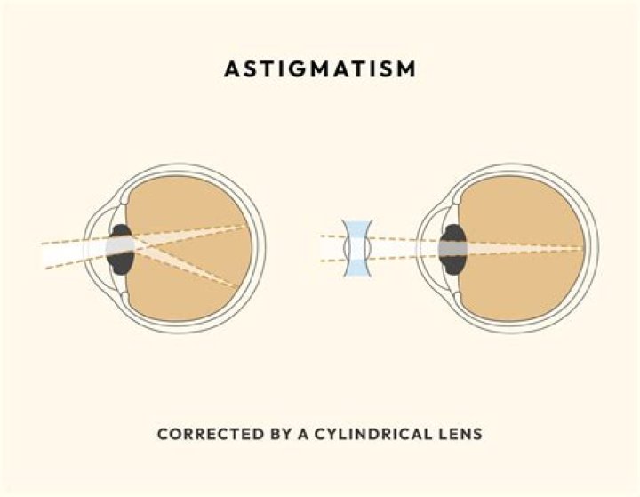 Do Glasses Help Astigmatism At Night? Mastery Wiki