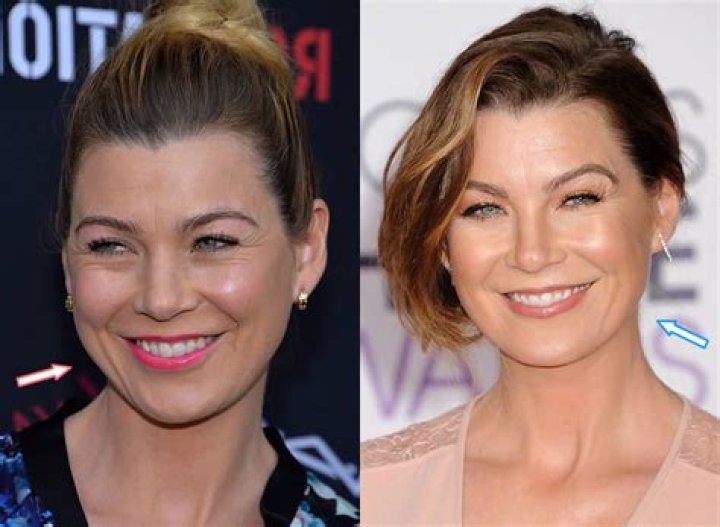 Ellen Pompeo facelift before and after Facelift before and after