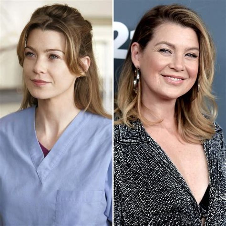 Ellen Pompeo Plastic Surgery Botox, Facelift, Lip scar, Lip injection