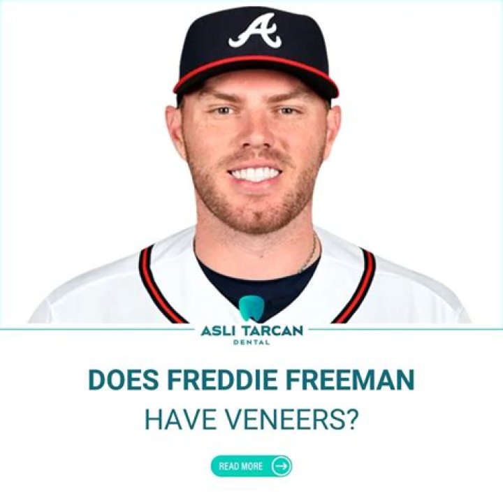 Freddie Freeman on the Braves&rsquo; strange season, his contract and his