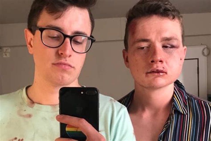 Gay couple assaulted, robbed on U Street in attack that used homophobic