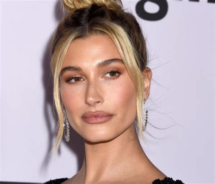 Hailey Bieber forteller Liten blodpropp i hjernen VG