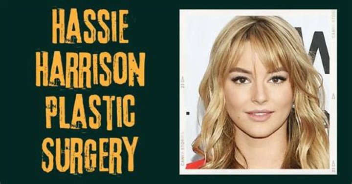 Hassie Harrison’s Plastic Surgery Know Everything About Her