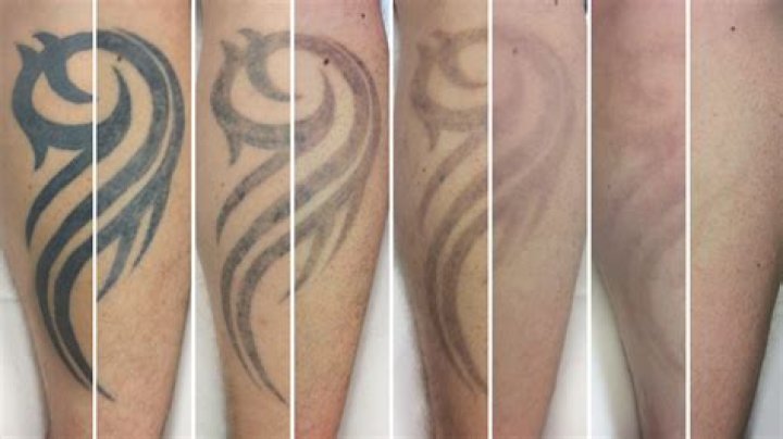 How Many Tattoo Zach Edey Have? Their Meanings And Designs