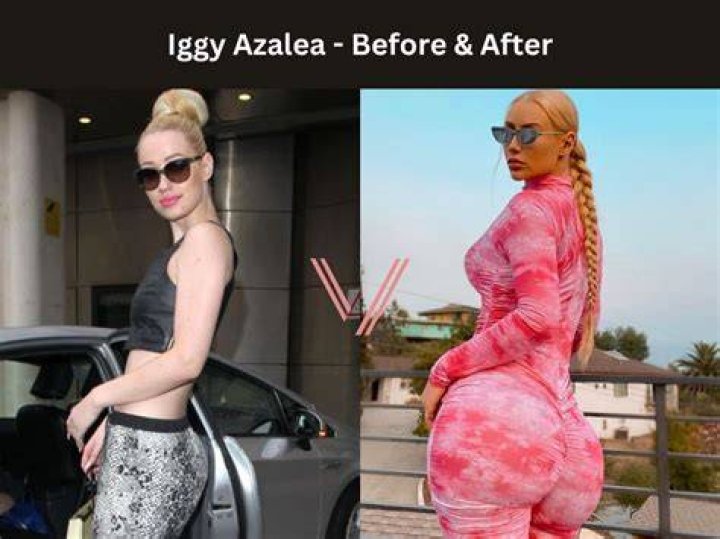 Iggy Azalea Height, Weight, Bra Size Body Measurements Iggy azalea