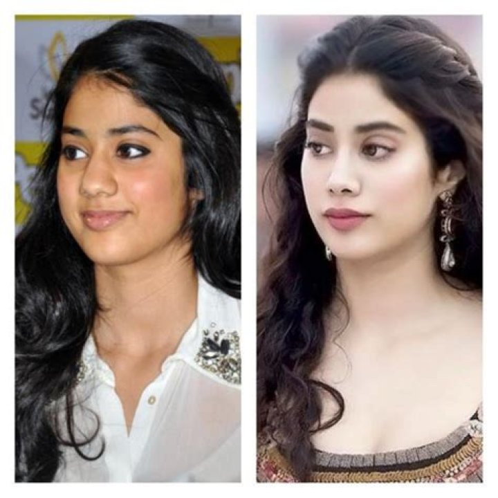 janhvi kapoor makeover plastic surgery Dr. Niketa Sonavane