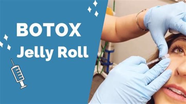 Jelly Rolls Botox in the Under Eye YouTube