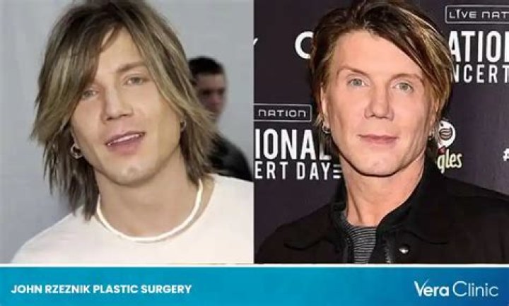 John Rzeznik Plastic Surgery Drastic Result Did John Rzeznik Have