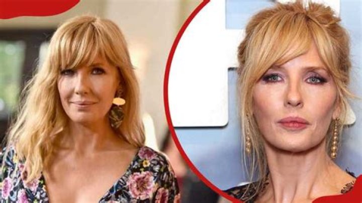 Kelly Reilly plastic surgery transformation Before and after pics