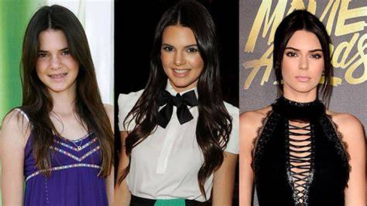 Kendall Jenner Through the Years Her Life in Photos