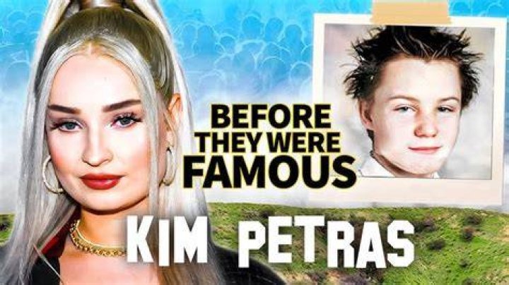 Kim Petras Before and After Transformation OtakuKart