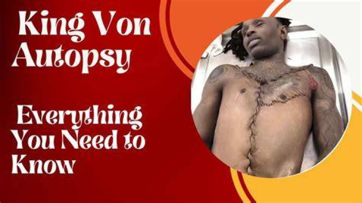 King Von Autopsy Photo Graphic EuropeanMagazine