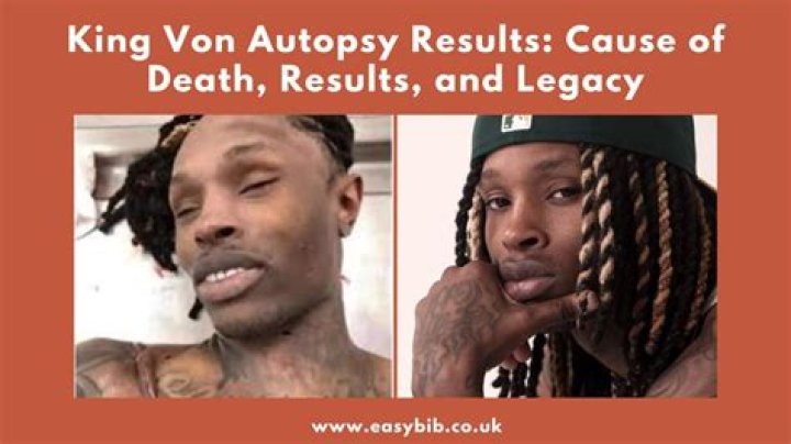 King Von Autopsy Real Cause of Death + Life Story (Early Life, Career