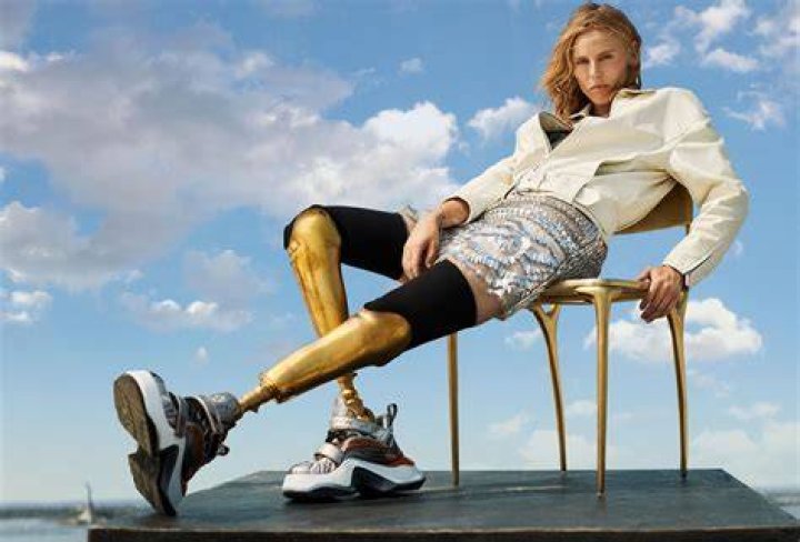 Lauren Wasser (Golden Legs Model) Wiki, Biography, Age, Wife