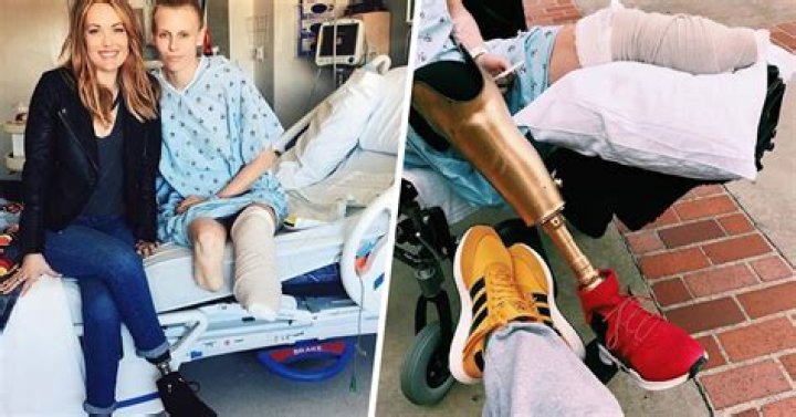 Lauren Wasser who lost leg to toxic shock files lawsuit against Kotex