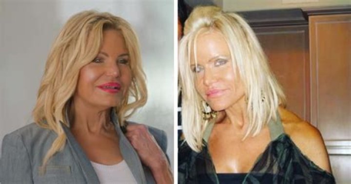 Lisa Helou Plastic Surgery DaiseyAleida