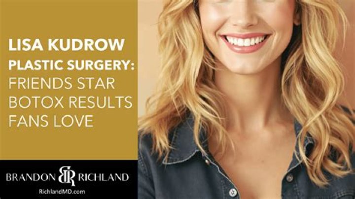 Lisa Helou&rsquo;s Plastic Surgery Has the Selling the OC Cast Undergone