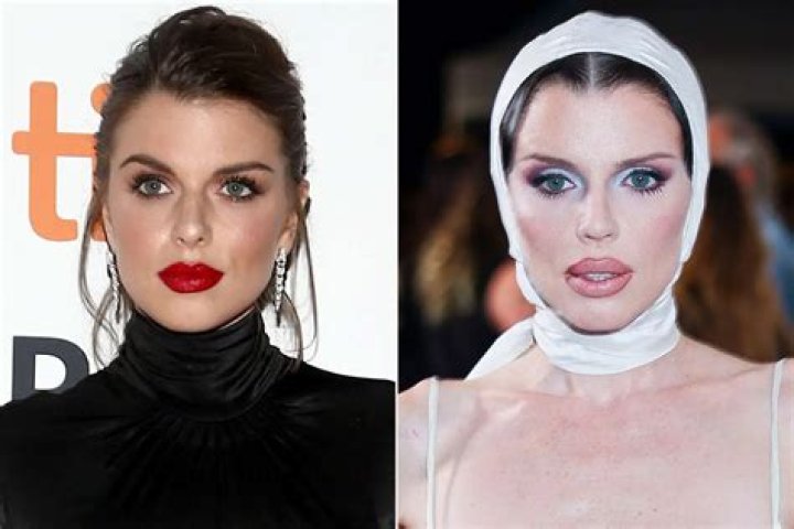 Maria Shriver&rsquo;s Plastic Surgery No Longer Recognizable While Spotted