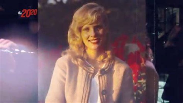 Marilyn Grabowski Face Plastic Surgery Before And After