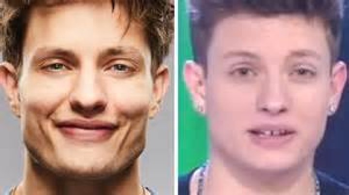 Matt Rife Before New Teeth Did He Wear Braces? Then And Now