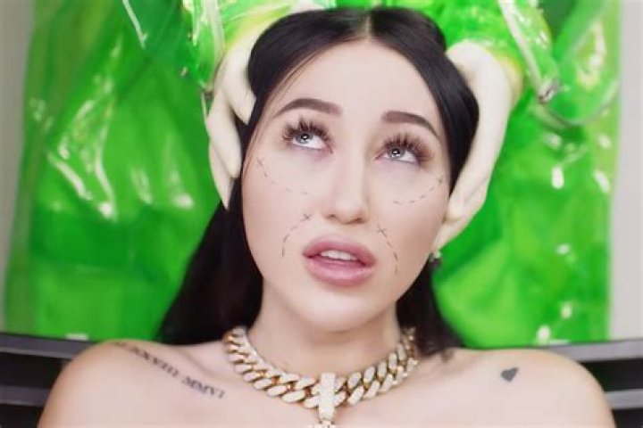 Noah Cyrus Goes Under the Knife in Gory ‘FckYouNoah’ Video Rolling Stone