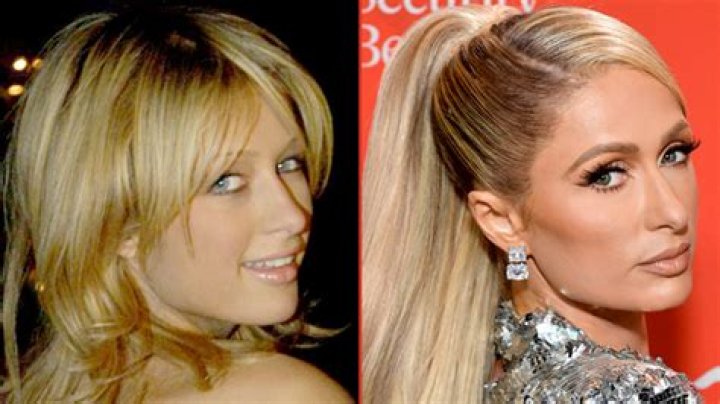 Paris Hilton Good Genes Or Good Docs?!