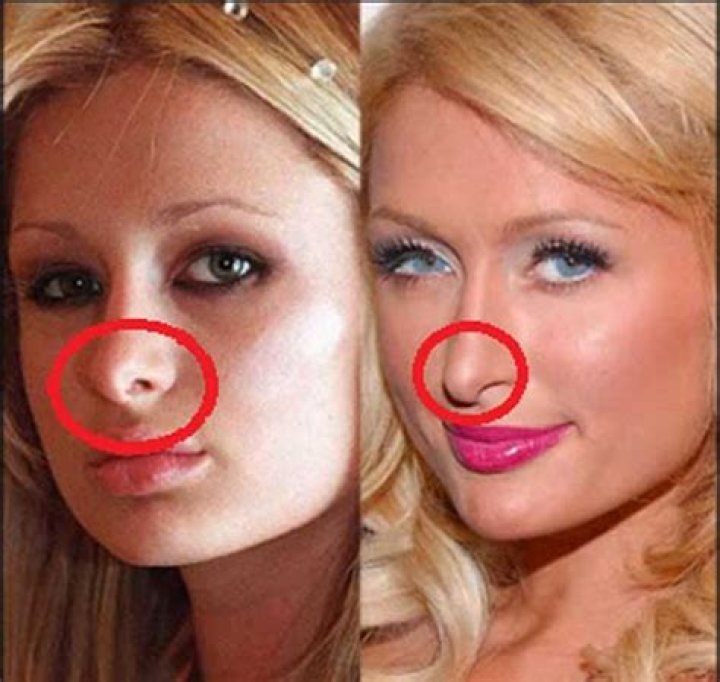 Paris Hilton slams nose job rumours with claims she never had surgery