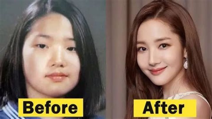 Park min young plastic surgery before and after pictures About Korean